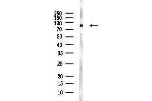 anti-Protein Kinase C, epsilon (PRKCE) (pSer729) antibody