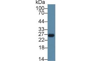 Detection of CEBPd in Rat Spleen lysate using Polyclonal Antibody to CCAAT/Enhancer Binding Protein Delta (CEBPd)