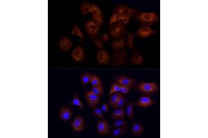Immunofluorescence analysis of A-549 cells using CYFIP1 Rabbit mAb (ABIN7266665) at dilution of 1:50 (40x lens). (CYFIP1 antibody)