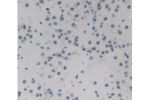 Used in DAB staining on fromalin fixed paraffin- embedded Kidney tissue (NUP214 antibody  (AA 601-868))