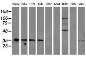 Image no. 11 for anti-Nonhomologous End-Joining Factor 1 (NHEJ1) antibody (ABIN1499729) (NHEJ1 antibody)