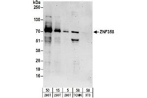 Western Blotting (WB) image for anti-Zinc Finger Protein 358 (ZNF358) (AA 518-568) antibody (ABIN7450940)