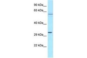 Image no. 1 for anti-Transforming Growth Factor beta Regulator 4 (TBRG4) (AA 323-372) antibody (ABIN6747963) (TBRG4 antibody  (AA 323-372))