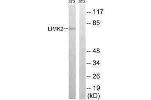 Western blot analysis of extracts from 3T3 cells, treated with PMA (125 ng/mL, 30 mins), using LIMK2 (Ab-283) antibody. (LIMK2 antibody  (Ser283))