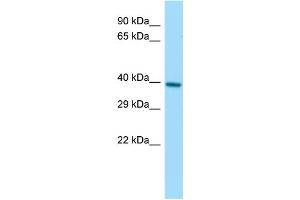 Host:  Rabbit  Target Name:  Pggt1b  Sample Type:  Rat Small Intestine lysates  Antibody Dilution:  1. (PGGT1B antibody  (C-Term))