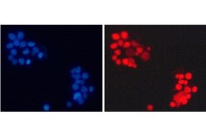 Immunofluorescence analysis of 293T cells using Asymmetric DiMethyl-Histone H3-R17 Polyclonal Antibody (Histone 3 antibody  (H3R17me2a))