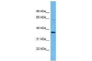 Western Blotting (WB) image for anti-Olfactory Receptor, Family 5, Subfamily H, Member 15 (OR5H15) (C-Term) antibody (ABIN2791757) (OR5H15 antibody  (C-Term))