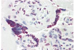 Formalin-Fixed, Paraffin-Embedded Human Placenta tissue stained with MCM3AP  Antibody  at 5 μg/ml after heat-induced antigen retrieval. (GANP antibody  (C-Term))