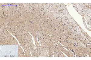 Immunohistochemical analysis of paraffin-embedded mouse heart tissue. (GLUT4 antibody  (N-Term))