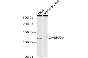 Western blot analysis of extracts of various cell lines, using RECQL4 antibody (ABIN6130663, ABIN6146846, ABIN6146847 and ABIN6222575) at 1:1000 dilution. (RECQL4 antibody  (AA 231-330))