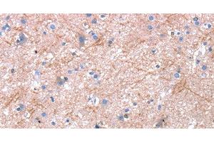 Immunohistochemistry of paraffin-embedded Human brain using Dap3 Polyclonal Antibody at dilution of 1:45 (DAP3 antibody)