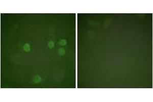 Immunofluorescence (IF) image for anti-Cyclin B1 (CCNB1) (AA 91-140) antibody (ABIN2888597) (Cyclin B1 antibody  (AA 91-140))