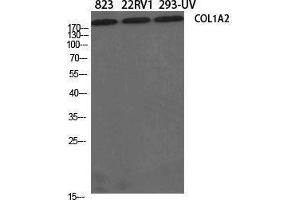 Western Blotting (WB) image for anti-Collagen, Type I, alpha 2 (COL1A2) (N-Term) antibody (ABIN3184006) (COL1A2 antibody  (N-Term))