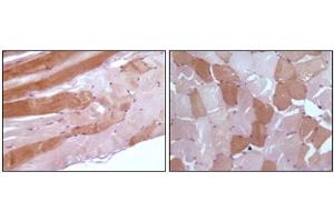 Immunohistochemistry (IHC) image for anti-Myoglobin (MB) antibody (ABIN1108360) (Myoglobin antibody)