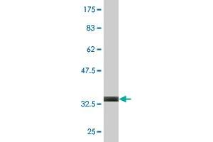 Western Blot detection against Immunogen (39. (RAMP3 antibody  (AA 24-148))