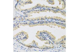 Immunohistochemistry of paraffin-embedded human prostate using CST3 antibody at dilution of 1:100 (40x lens). (CST3 antibody)