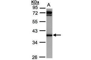 Western Blotting (WB) image for anti-Dihydrodiol Dehydrogenase (DDH) antibody (ABIN2856139)