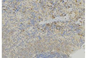ABIN6272918 at 1/100 staining Human lymph node tissue by IHC-P. (GDI2 antibody  (Internal Region))