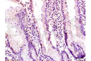 Formalin-fixed and paraffin embedded rat small intestine labeled with Anti-Egr1 Polyclonal Antibody, Unconjugated (ABIN737301) at 1:200 followed by conjugation to the secondary antibody and DAB staining. (EGR1 antibody  (AA 401-453))