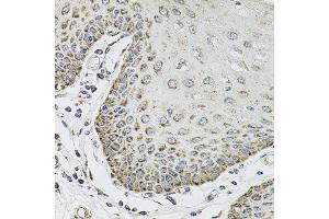 Immunohistochemistry of paraffin-embedded human esophagus using SDC2 antibody at dilution of 1:100 (x40 lens). (Syndecan 2 antibody)