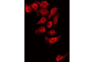 ABIN6279089 staining HepG2 by IF/ICC. (Adamts2 antibody  (Internal Region))