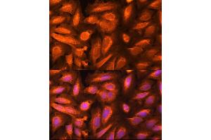Immunofluorescence analysis of U-2 OS cells using DTYMK Rabbit pAb (ABIN6133500, ABIN6139855, ABIN6139856 and ABIN6221989) at dilution of 1:100 (40x lens). (DTYMK antibody  (AA 1-212))