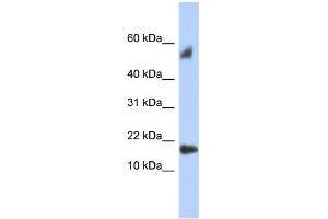 WB Suggested Anti-FLJ35767 Antibody Titration: 0. (FLJ35767 (Middle Region) antibody)