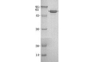Validation with Western Blot (MMP3 Protein (His tag))