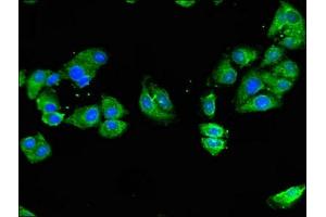 Immunofluorescent analysis of HepG2 cells using ABIN7162073 at dilution of 1:100 and Alexa Fluor 488-congugated AffiniPure Goat Anti-Rabbit IgG(H+L) (NOD2 antibody  (AA 460-733))