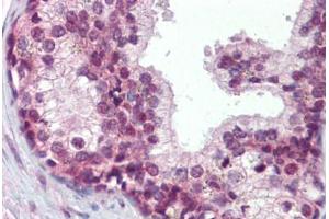 Human Prostate (formalin-fixed, paraffin-embedded) stained with ELF4 antibody ABIN462321 followed by biotinylated goat anti-rabbit IgG secondary antibody ABIN481713, alkaline phosphatase-streptavidin and chromogen. (Elf4 antibody  (AA 211-237))