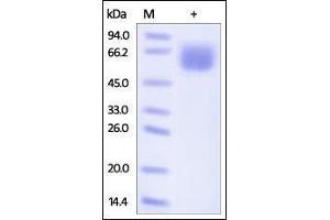Human CD98, His Tag on SDS-PAGE under reducing (R) condition. (SLC3A2 Protein (AA 206-630) (His tag))