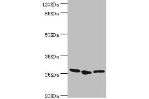 Western blot All lanes: YEATS4 antibody at 1. (GAS41 antibody  (AA 1-227))