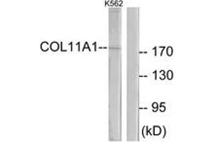 Western blot analysis of extracts from K562 cells, using Collagen XI alpha1 Antibody. (COL11A1 antibody  (AA 581-630))