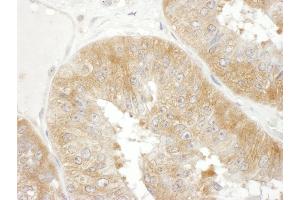Immunohistochemistry (IHC) image for anti-Eukaryotic Translation Initiation Factor 3 Subunit F (EIF3F) (AA 307-357) antibody (ABIN7453696)