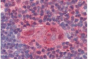 Human Thymus (formalin-fixed, paraffin-embedded) stained with UNG antibody ABIN364332 at 10 ug/ml followed by biotinylated anti-mouse IgG secondary antibody ABIN481714, alkaline phosphatase-streptavidin and chromogen. (UNG antibody  (AA 1-313))