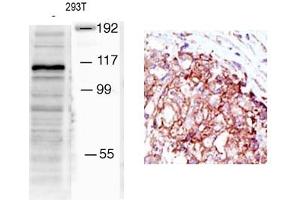Image no. 1 for anti-Mindbomb E3 Ubiquitin Protein Ligase 1 (MIB1) (N-Term) antibody (ABIN357602) (MIB1 antibody  (N-Term))