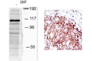 Image no. 1 for anti-Mindbomb E3 Ubiquitin Protein Ligase 1 (MIB1) (N-Term) antibody (ABIN357602) (MIB1 antibody  (N-Term))