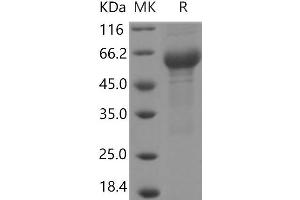 Interleukin 6 Receptor, alpha (IL6RA) (Active) protein (His tag,ECD)