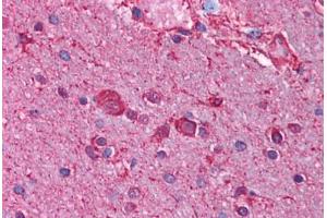 Human Brain, Cortex (formalin-fixed, paraffin-embedded) stained with CHRNB3 antibody ABIN214743 at 2. (CHRNB3 antibody  (AA 176-225))