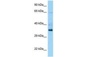 Image no. 1 for anti-Tripartite Motif Containing 44 (TRIM44) (C-Term) antibody (ABIN6748290)