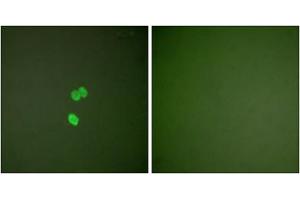 Immunofluorescence analysis of NIH/3T3 cells, using Galectin 3 antibody (ABIN5976406).