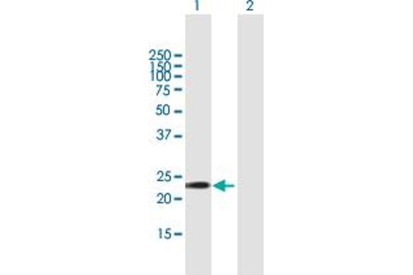 GSTa5 anticorps  (AA 1-222)