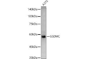Western blot analysis of extracts of  cells, using GSDMC antibody (ABIN7268463) at 1:1000 dilution. (MLZE antibody  (AA 1-100))