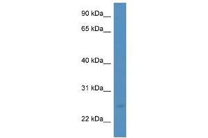 WB Suggested Anti-MANF  Antibody Titration: 0. (MANF antibody  (C-Term))