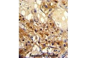 Immunohistochemistry (IHC) image for anti-Cytochrome P450, Family 20, Subfamily A, Polypeptide 1 (CYP20A1) antibody (ABIN3003220)