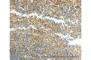Immunohistochemistry of Human tonsil using CFHR1 Polyclonal Antibody at dilution of 1:40