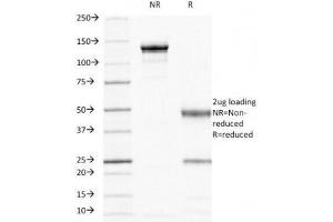 SDS-PAGE Analysis of Purified, BSA-Free HCAM Antibody (clone 156-3C11). (CD44 antibody)