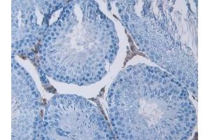Immunohistochemistry (IHC) image for anti-Carbonic Anhydrase II (CA2) (AA 1-260) antibody (ABIN7438433)