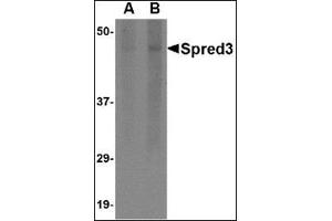 Western blot analysis of Spred3 in human brain tissue lysate with this product at (A) 2 and (B) 4 μg/ml. (SPRED3 antibody  (Center))