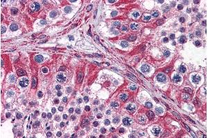 ABIN308447 (3. (PCSK6 antibody  (Internal Region))